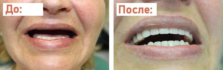 Стоматологические услуги Минск